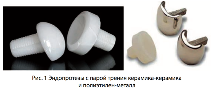 Рис. 1 Эндопротезы с парой трения