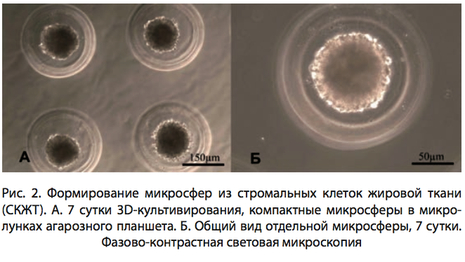 Рис. 2. Формирование микросфер