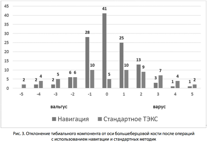 Рис. 3. Отклонение тибиального компонента
