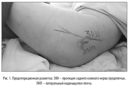 рис1