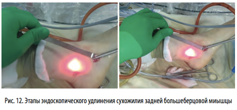 рис12