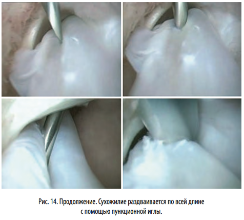 рис14