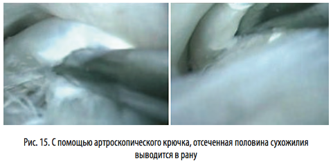 рис15