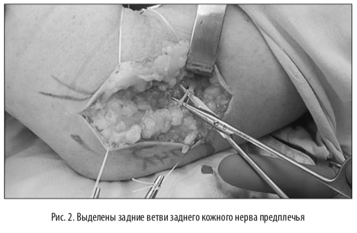 рис2