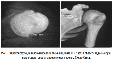 рис3