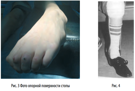 рис3 4