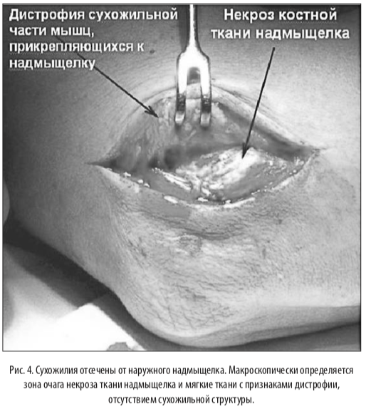 рис4