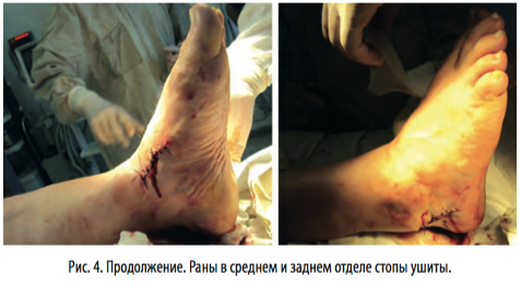 рис4