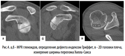 рис4