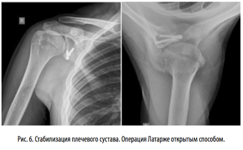 рис6