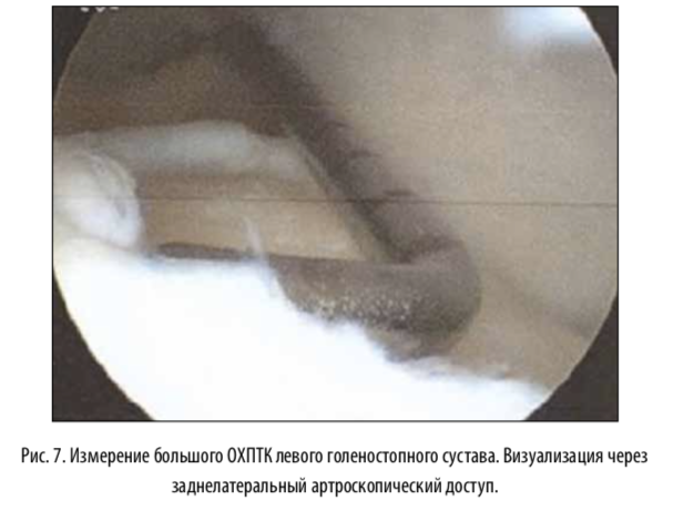 рис7