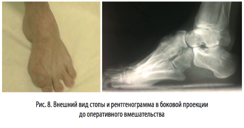 рис8