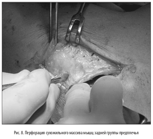 рис8