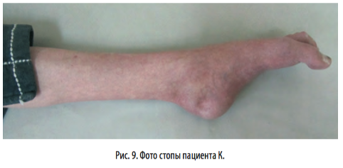 рис9