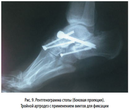 рис9