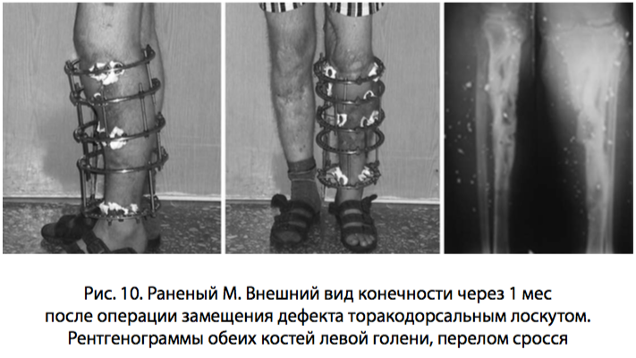 рис 10