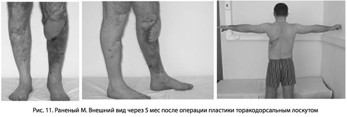рис 11