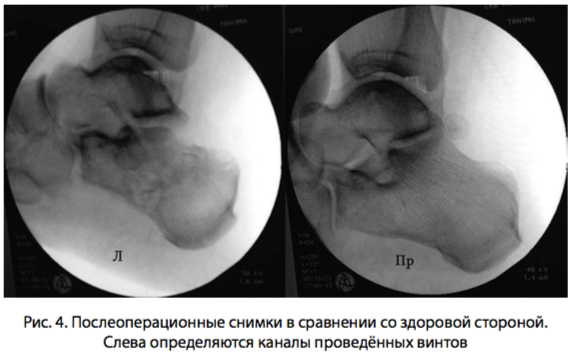 рис 4