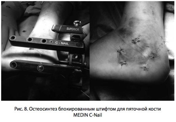 рис 8